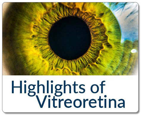Highlights of Vitreoretina